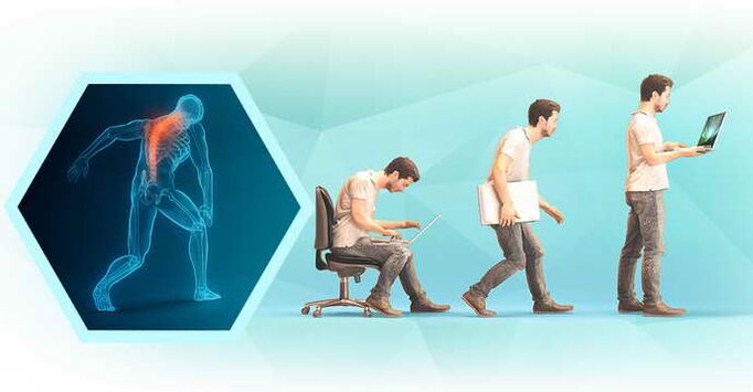 prasta laikysena dirbant kompiuteriu ir krūtinės ląstos osteochondrozė
