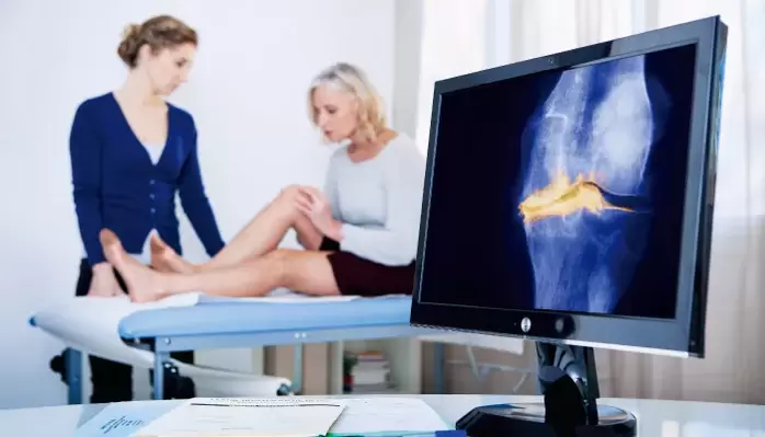 sąnario artrozė moteriai