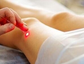 Kelio sąnario artrozės gydymas lazeriu